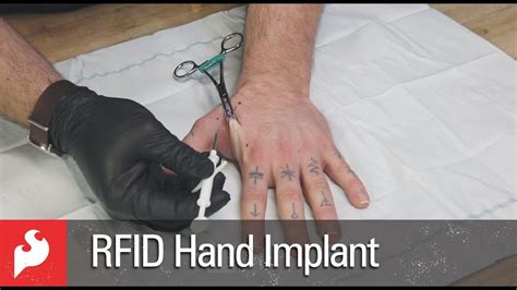 new rfid chip|rfid implants in the hand.